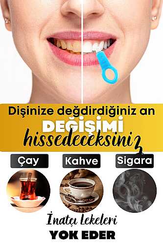Diş Leke Silgisi 1 Aparatlı + 5 Yedek Süngerli Set X 16 Adetli Stand Box - 2